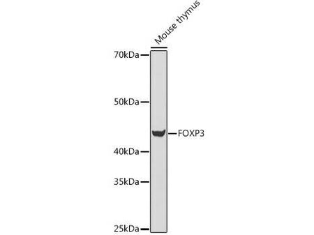 FOXP3 Polyclonal Antibody