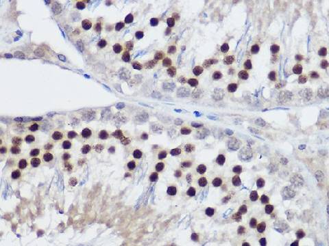 PLZF Polyclonal Antibody