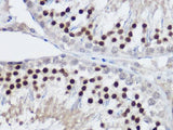PLZF Polyclonal Antibody
