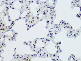 PLZF Polyclonal Antibody
