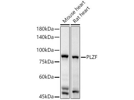 PLZF Polyclonal Antibody