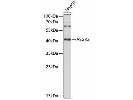ASGR2 Polyclonal Antibody