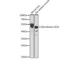 Glucokinase (GCK) Polyclonal Antibody