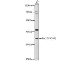 Fbx32/FBOX32 Polyclonal Antibody, Biomarkers, Elabscience Biotechnology, MSE Supplies
