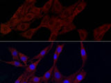 PLK2 Polyclonal Antibody