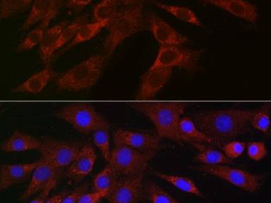 PLK2 Polyclonal Antibody