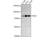PLK2 Polyclonal Antibody