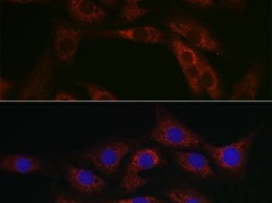ABCA1 Polyclonal Antibody