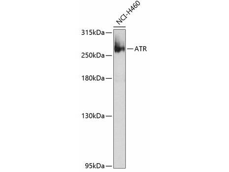 ATR Polyclonal Antibody