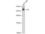 ATR Polyclonal Antibody