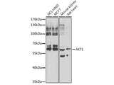 AKT1 Polyclonal Antibody