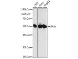 RARα Polyclonal Antibody