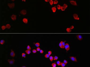NMDAR1 Polyclonal Antibody