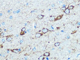 NMDAR1 Polyclonal Antibody