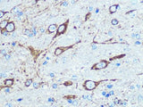 NMDAR1 Polyclonal Antibody