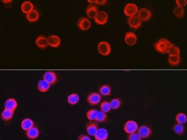 CFTR Polyclonal Antibody