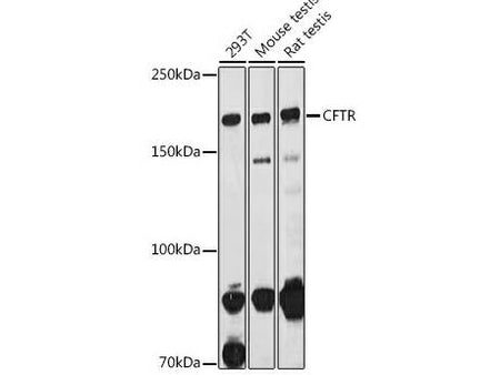 CFTR Polyclonal Antibody