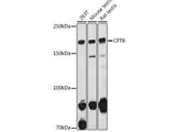 CFTR Polyclonal Antibody