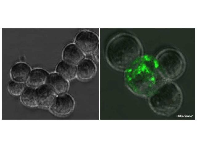 SARS-COV-2 Spike S1 Monoclonal Antibody(2019-nCoV)