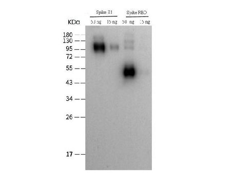 SARS-COV-2 Spike RBD Polyclonal Antibody (2019-nCoV)