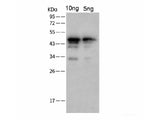 SARS-COV-2 NP Polyclonal Antibody(2019-nCoV) Unconjugated