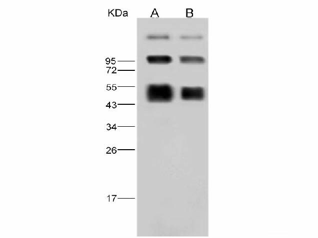Anti-Dengue Virus DENV-2(Strain New Guinea C) NS1 Polyclonal Antibody