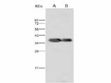 Anti-Dengue Virus DENV-2(Strain New Guinea C) NS5(Methyltransferase Domain) /Nonstructural Protein 5 Polyclonal Antibody