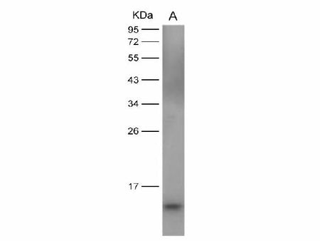 Anti-Dengue Virus DENV-2(Strain New Guinea C/PUO-218 Hybrid) E/Envelope Protein(Domain III) Monoclonal Antibody Store at -20°C