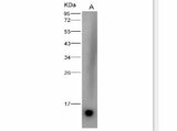 Anti-Dengue Virus DENV-2(Strain New Guinea C/PUO-218 Hybrid) E/Envelope Protein(Domain III) Monoclonal Antibody