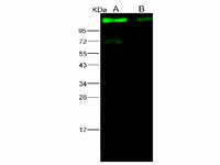 Anti-Ebola Virus EBOV(Subtype Sudan, Strain Gulu) Glycoprotein/GP1(Mucin Domain Deleted) Monoclonal Antibody Store at -20°C