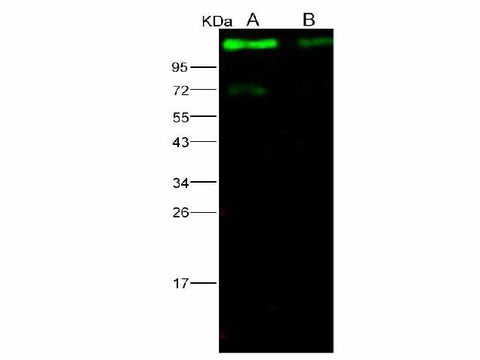 Anti-Ebola Virus EBOV(Subtype Sudan, Strain Gulu) Glycoprotein/GP1(Mucin Domain Deleted) Monoclonal Antibody Store at -20°C