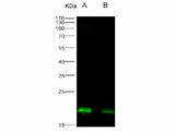 Anti-Ebola Virus EBOV(Sudan Ebolavirus, Strain Gulu) Nucleoprotein/NP Monoclonal Antibody