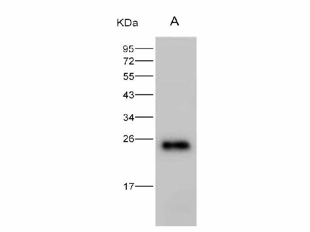 Anti-HIV-1 p24 Protein(Group M, Subtype B, Strain 92418) Polyclonal Antibody Host: Rabbit