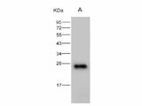 Anti-HIV-1 p24 Protein(Group M, Subtype B, Strain 92418) Polyclonal Antibody Host: Rabbit