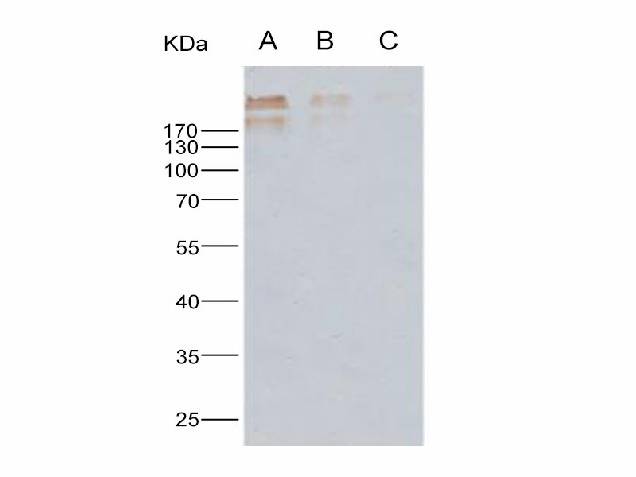 Anti-Human Cytomegalovirus(HCMV) Glycoprotein B/gB Monoclonal Antibody Store at -20°C