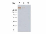Anti-Human Cytomegalovirus(HCMV) Glycoprotein B/gB Monoclonal Antibody Store at -20°C