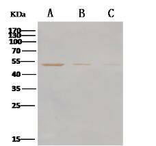 Anti-MERS-CoV Nucleocapsid Protein Polyclonal Antibody Store at -20°C