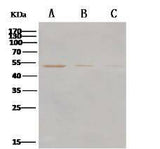 Anti-MERS-CoV Nucleocapsid Protein Polyclonal Antibody Store at -20°C