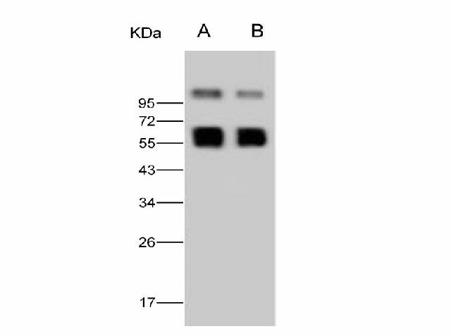 Anti-West Nile Virus(WNV)(Lineage 1, Strain NY99) NS1 Polyclonal Antibody