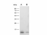 Anti-Zika virus(ZIKV)(Strain Zika SPH2015) ZIKV-E/Envelope Protein(Domain III) Monoclonal Antibody Store at -20°C