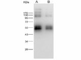 Anti-Zika virus(ZIKV)(strain Zika SPH2015) ZIKV-NS1 Monoclonal Antibody Store at -20°C