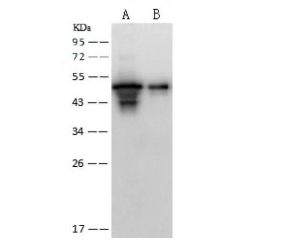 Anti-SARS-CoV Nucleoprotein / NP Polyclonal Antibody