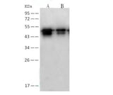 Anti-SARS-CoV Nucleoprotein / NP Monolonal Antibody