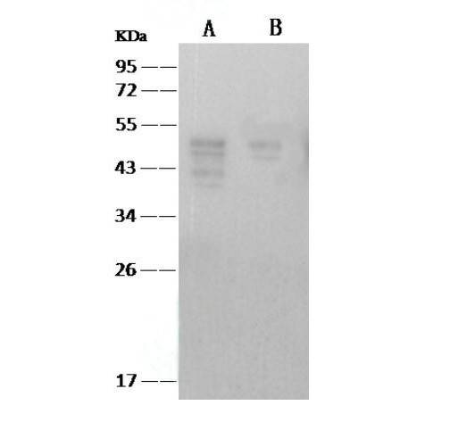 Anti-SARS-CoV Nucleoprotein / NP Monolonal Antibody
