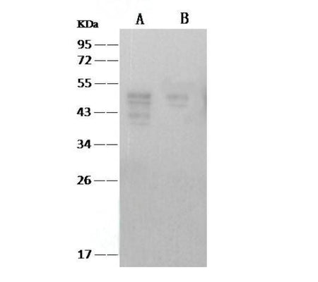 Anti-SARS-CoV Nucleoprotein / NP Monolonal Antibody