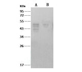 Anti-SARS-CoV Nucleoprotein / NP Monolonal Antibody