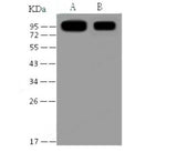 Anti-SARS-CoV Spike S1 Monoclonal Antibody - MSE Supplies LLC