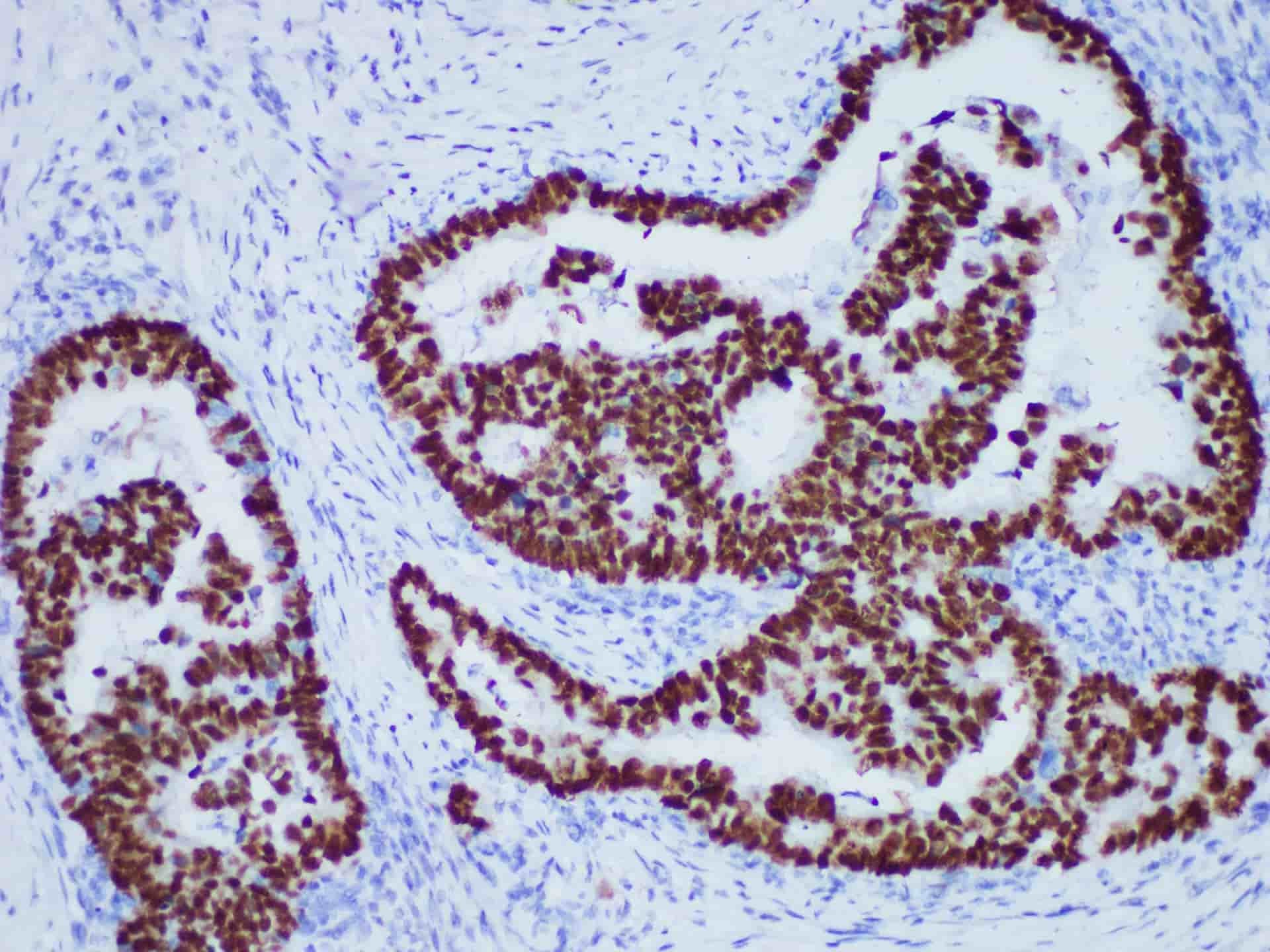 p53 Monoclonal Antibody Stored at -20°C