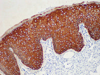 CK5/6 Monoclonal Antibody Stored at -20°C