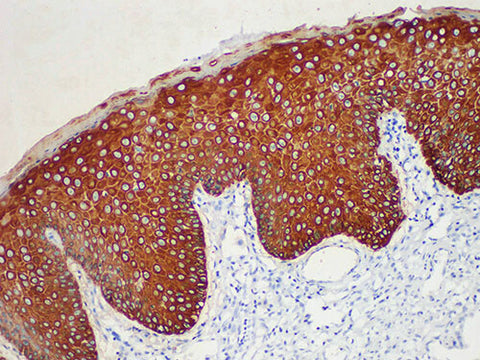 CK5/6 Monoclonal Antibody Stored at -20°C